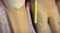 frame 11 link