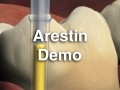 Arestin