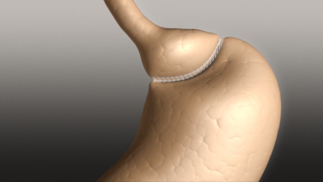 fram_11