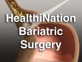 HN_bari