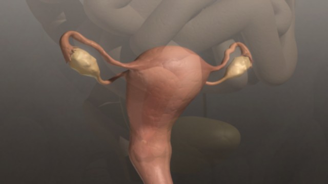 fram_02