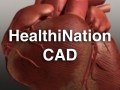 HN_cad
