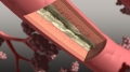 frame 11 link