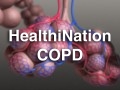 HN_copd