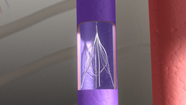 fram_12