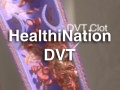 HN_dvt