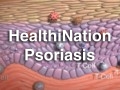 HN_psor