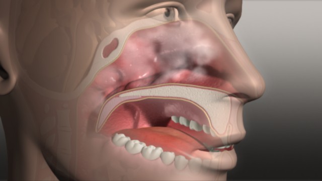 fram_06