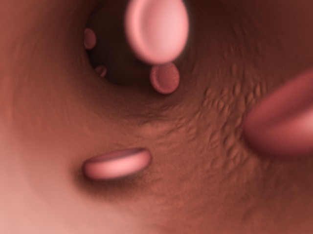 fram_02