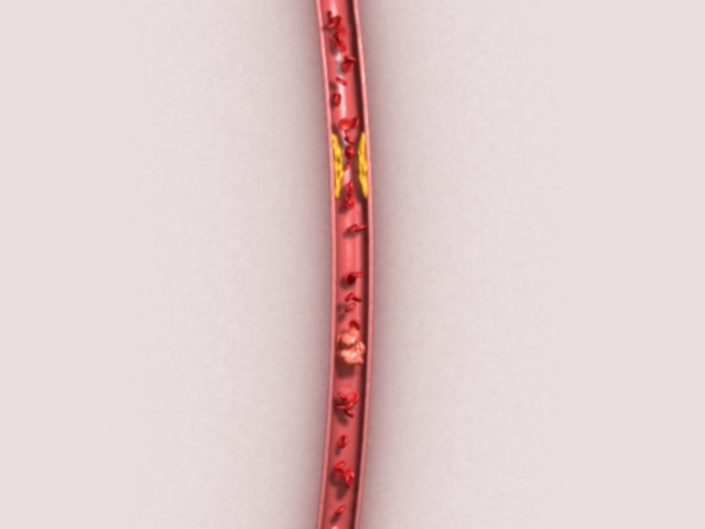fram_08