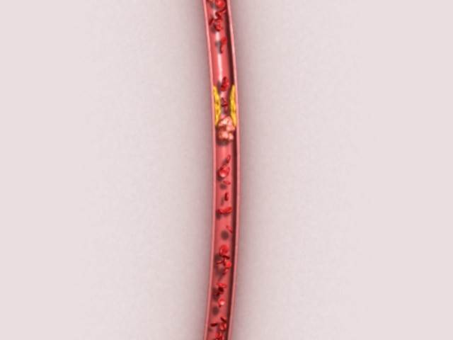 fram_09